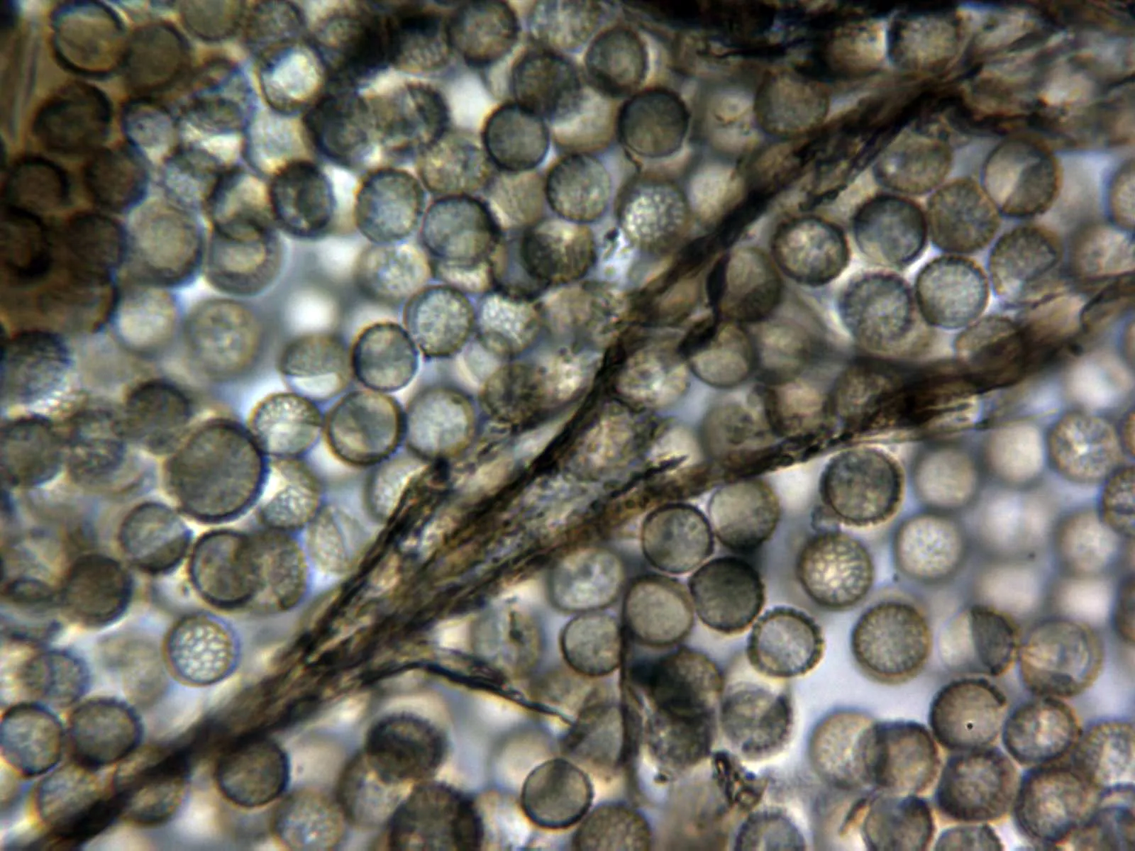Microscopía de Reticularia lycoperdon - 10 - Pseudocapilicio agua